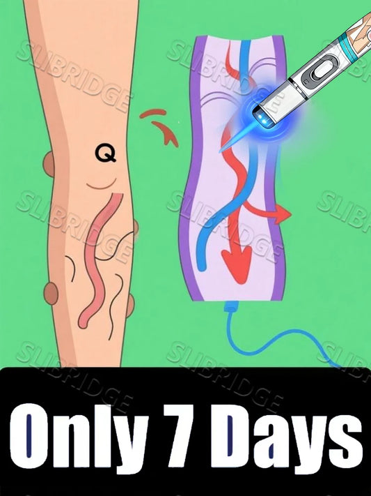 2025  hot sale Blue light pen Says Goodbye To all veins In 7 Days Leg care tools Reduce Uncomfortable For Legs
